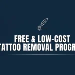 Tattoo Removal Program