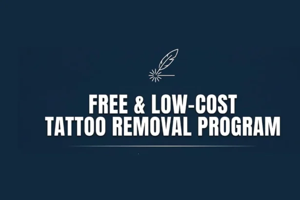 Tattoo Removal Program