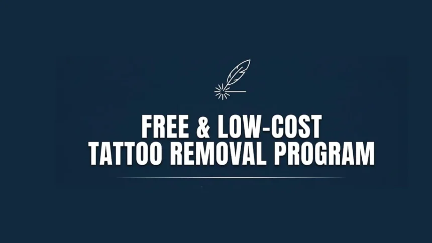 Tattoo Removal Program